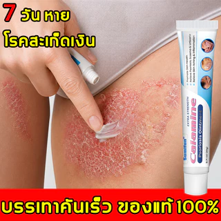 ครีมแก้คัน ครีมสะเก็ดเงิน ดูแลโรคผิวหนัง กลาก เกลื้อน อาการคัน คันเรื้อรัง และคันบริเวณจุดซ่อนเร้น