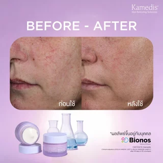 Kamedis | Bio Balance Face Cream 50 ML ไบโอ บาลานซ์ เฟซ ครีม 50 มิลลิลิตร