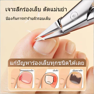 กรรไกรตัดเล็บ ขอบเล็บ คมกริบ เล็บขบ เล็บหนา เล็บแข็ง ตัดเล็บขบได้ดี ทนทาน เครื่องมือดูแลเท้า