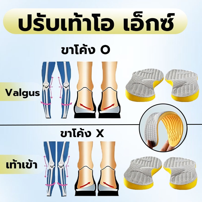 ขารูปตัว xo  แผ่นรองเท้า ลูกวัว แก้ไขเท้าแบน   ระงับกลิ่นกายเหงื่อ
