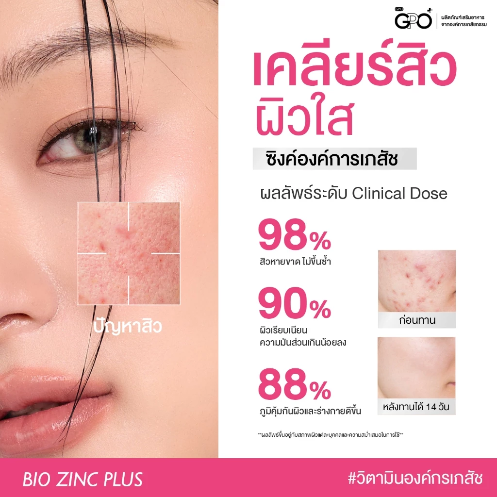 [1แถม1] GPO PLUS BIO ZINC PLUS | ไบโอ ซิงค์ ผิวแข็งแรง ดูแลปัญหาสิว แก้ผิวโทรม โดย GPO Plus องค์การเภสัชกรรม thumbnail 7