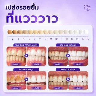YOOMU ยาสีฟันสีม่วง ฟอกฟันขาว ลดคราบเหลือง ลดกลิ่นปาก ป้องกันฟันผุ 50g