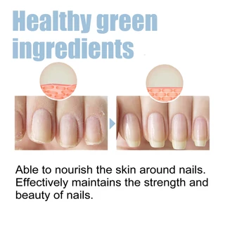 OceAura เซรั่มบำรุงเล็บ บำรุงเล็บเร่งยาว เล็บพัง Nail Serum