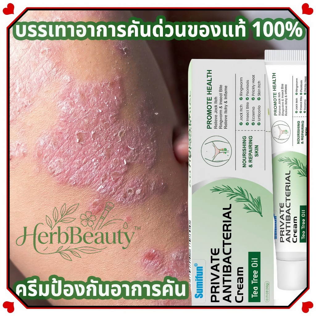 ☘️ครีมทาสังคัง สะเก็ดเงินครีม ครีมบำรุงผิว 20g รอยแดง โรคผิวหนัง เกลื้อน กลาก คัน สมุนไพร แก้คันเรื้อรัง คันในร่มผ้า