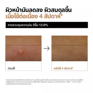 Anua Rice 70 Glow Milky Toner อานัว โทนเนอร์ข้าว เนื้อน้ำนม ผิวโกลว์กระจ่างใส ผิวกลาสสกิน ผิวนุ่มชุ่มชื้น แข็งแรง 250ml