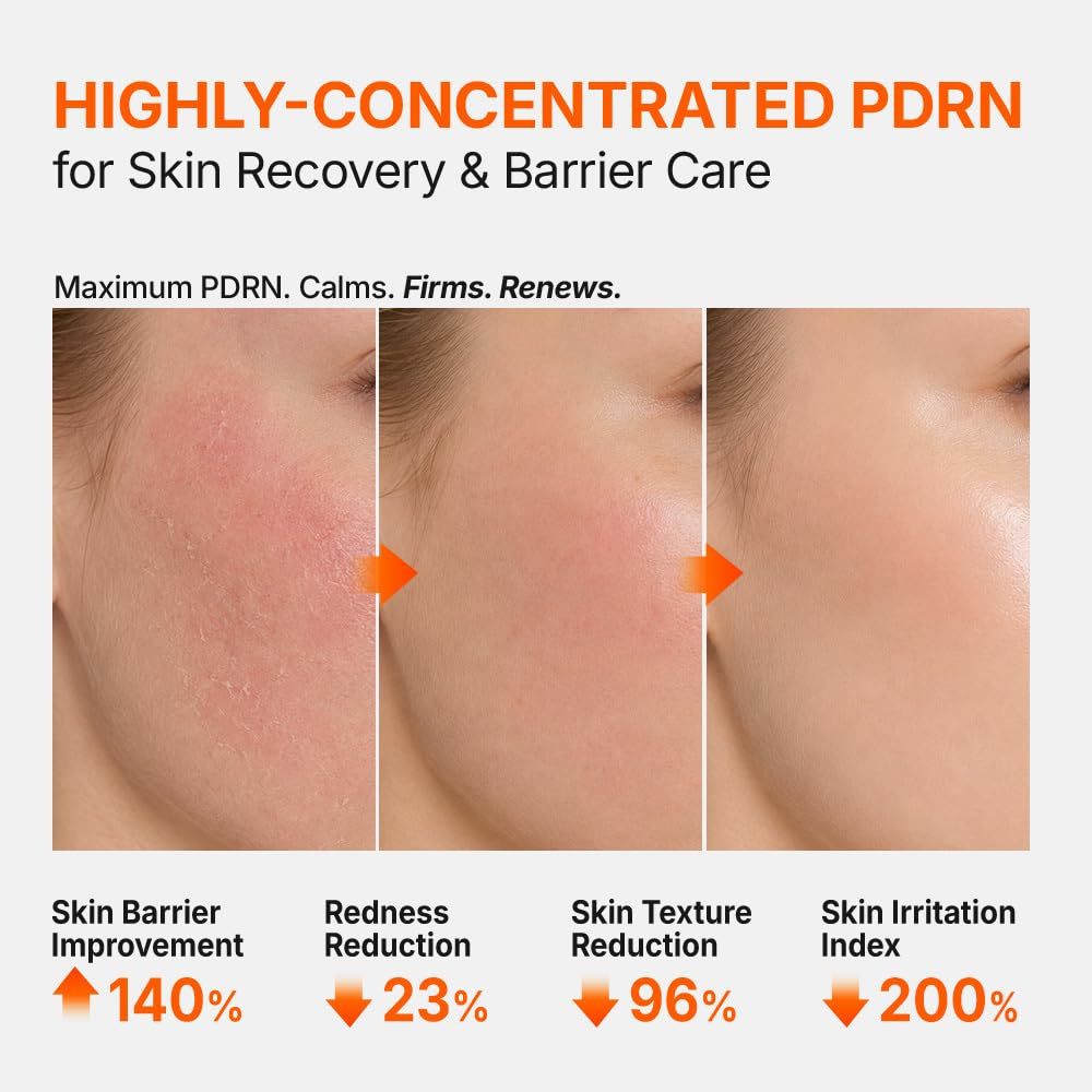 (แท้ / พร้อมส่ง) Genabelle PDRN 3% Hyper Boost Ampoule 40 รูปที่ 4