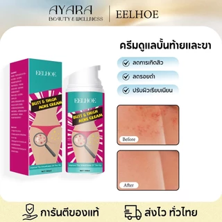 EELHOE ครีมที่ก้น ก้นสิวครีม ลบสะโพกสิว รอยสิ ก้นเนียน ป้องกันรูขุมขนอุดตัน ดูแลก้น ครีมบำรุงผิว