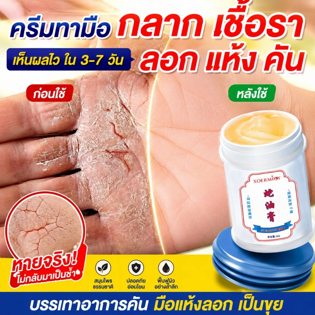 ครีมน้ำมันม้าฟื้นฟูผิวมือเท้า 30กรัม แก้ปัญหาผิวแห้งกร้าน ลดผิวด้านดำ ผิวเนียนนุ่มขาว