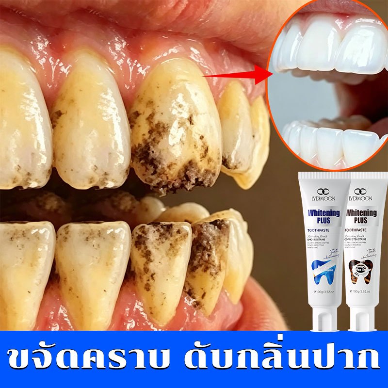 LYDIMOONฟอกฟันขาวยาสีฟัน Toothpaste   ฟันขาว ลดฟันเหลือง ลดกลิ่นปาก ขจัดคราบหินปูน ปากหอม ลมหายใจสดช