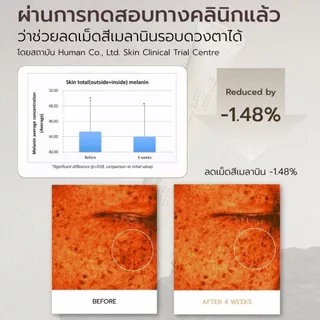 สินค้าแถมฟรีเมื่อซื้อครบ 1,190.- (Black Rice Bakuchiol Eye Cream 20 ml.) 1-31 ก.ค. 69
