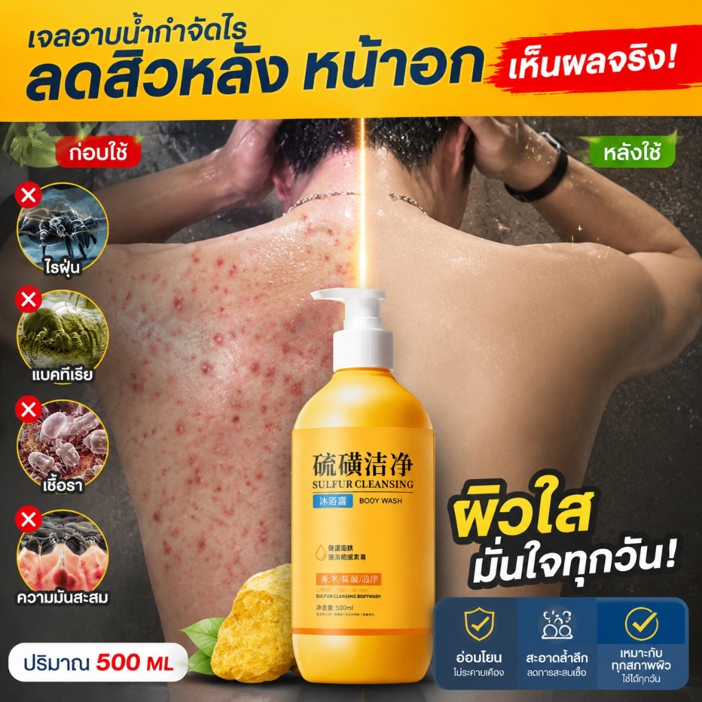 เจลอาบน้ำสูตรกำมะถัน 3ฟังก์ชันในหนึ่งขวด ขจัดไรฝุ่นไรกำมะถัน ผิวสะอาดกระจ่างใส
