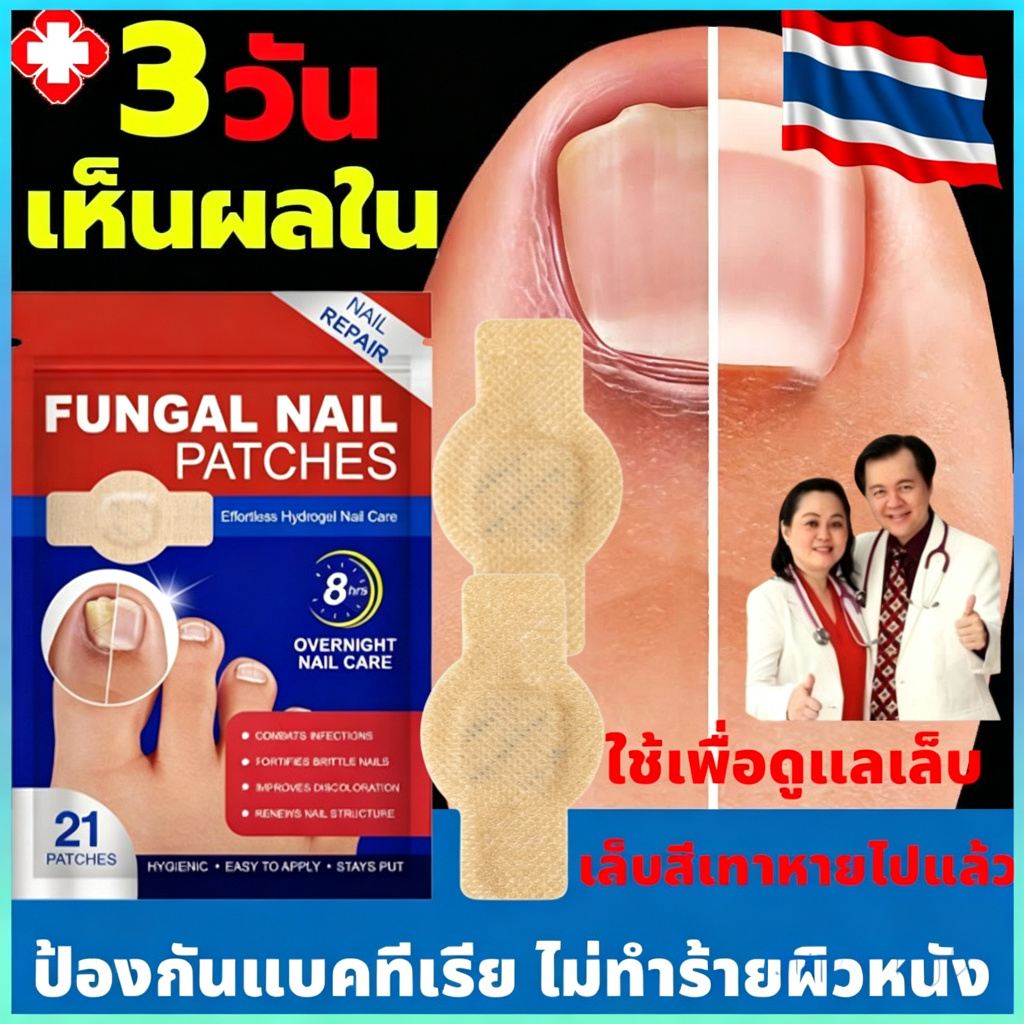 แผ่นแปะเชื้อราเล็บ COD เหมาะสำหรับการติดเชื้อราเล็บ ช่วยเสริมความแข็งแรงของเล็บ ใช้งานสะดวก มีเนื้อสัมผัสนุ่มไม่ข้างคาง