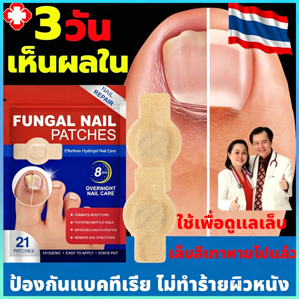 แผ่นแปะเชื้อราเล็บ COD💯 เหมาะสำหรับการติดเชื้อราเล็บ ช่วยเสริมความแข็งแรงของเล็บ ใช้งานสะดวก มีเนื้อสัมผัสนุ่มไม่ข้างคาง