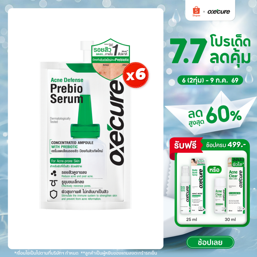 [แพ็ค 6] Oxe'cure เซรั่มลดรอยสิว Acne Defense Prebio Serum 5 ml ลดการอักเสบ เพิ่มความชุ่มชื้น 10OX00107X6
