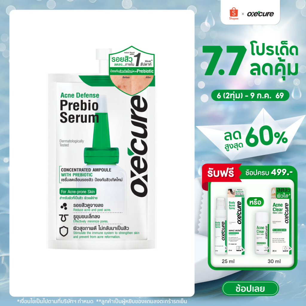 Oxe'cure เซรั่มลดรอยสิว Acne Defense Prebio Serum 5 ml ลดการอักเสบ เพิ่มความชุ่มชื้น 10OX00107