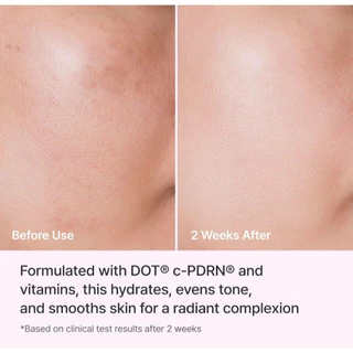 REJURAN Triple Radiance Cream c-PDRN 0.2% 50 ml รีจูรัน ทริปเพิ่ล เรเดี๊ยนซ์ ครีม