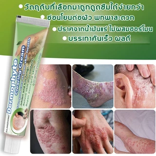 ครีมทาสังคัง สะเก็ดเงินครีม ครีมบำรุงผิว 20g รอยแดง โรคผิวหนัง เกลื้อน กลาก คัน สมุนไพร แก้คันเรื้อรัง คันในร่มผ้า