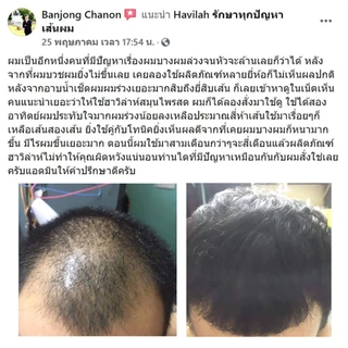 ฮาวิล่าห์ เจแปน โทนิคเสริมสร้างเส้นผมใหม่ ให้ผมดูหนามีวอลลุ่มขึ้น ขนาด 100 มล.