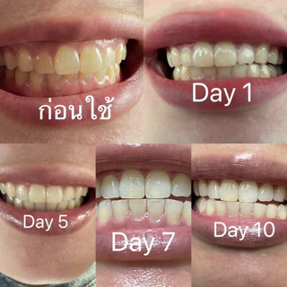 🇺🇸🔥ปรึกษาได้ แผ่นแปะฟันขาว Crest 3D Whitestrips Luxe Professional Effects ของแท้จาก USA ยาสีฟัน ฟันขาว
