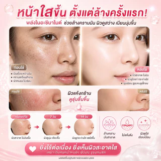 LYDIMOON โฟมล้างหน้าไนอะซินาไมด์ 100g ควบคุมความมัน ลดสิว ผิวกระจ่างใส ล้างล้ำลึก ไม่ตึงผิว ใช้ได้ทุกเพศ (COD)