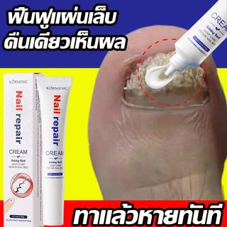 ยาทาเชื้อราที่เล็บ สำหรับดูแลเชื้อราที่เล็บ บรรเทาเล็บขบ ดูแลความสะอาดเล็บ น้ำยาบำรุงเล็บ เชื้อราที่เล็บ
