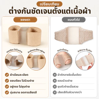 Klenik แยกนิ้วเท้า ซิลิโคน แยกนิ้วเท้า ตาปลา แยก ตาปลา Hallux Valgus แก้ไข นิ้วหัวแม่มือ แก้ไข ที่หนีบ ดูแลเท้า