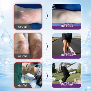 Kreain Nature เจลสมุนไพรดูแลข้อเข่า 50 กรัม สำหรับอาการปวดข้อเข่า บวม ข้อตึง เคลื่อนไหวไม่สะดวก จากยืนนานและออกกำลังกาย