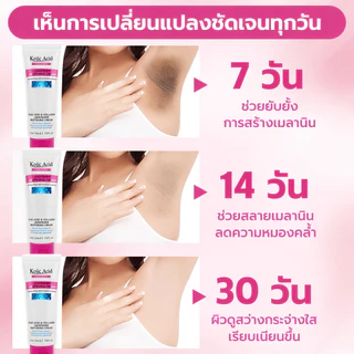 Kojic Acid ครีมบำรุงผิว 50ml ทารักแร้ ขาหนีบ เข่า คอดำ ปรับผิวให้ขาวกระจ่างใส