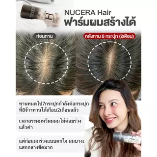 NUCERA H [นูเซร่า เอช] วิตามินลดผมร่วง กู้ผมสวย เพิ่มผมหนา และเร่งสร้างผมใหม่ลึกถึงรากผม