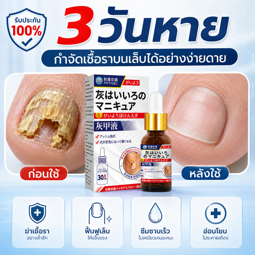 [เห็นผลใน 3 วัน] น้ำยารักษาเล็บเชื้อรา เชื้อราเล็บ ลบ โรคเชื้อราที่เล็บ รักษาเล็บคุด ซ่อมแซมสาระสําคัญบํารุงเล็บ รักษา