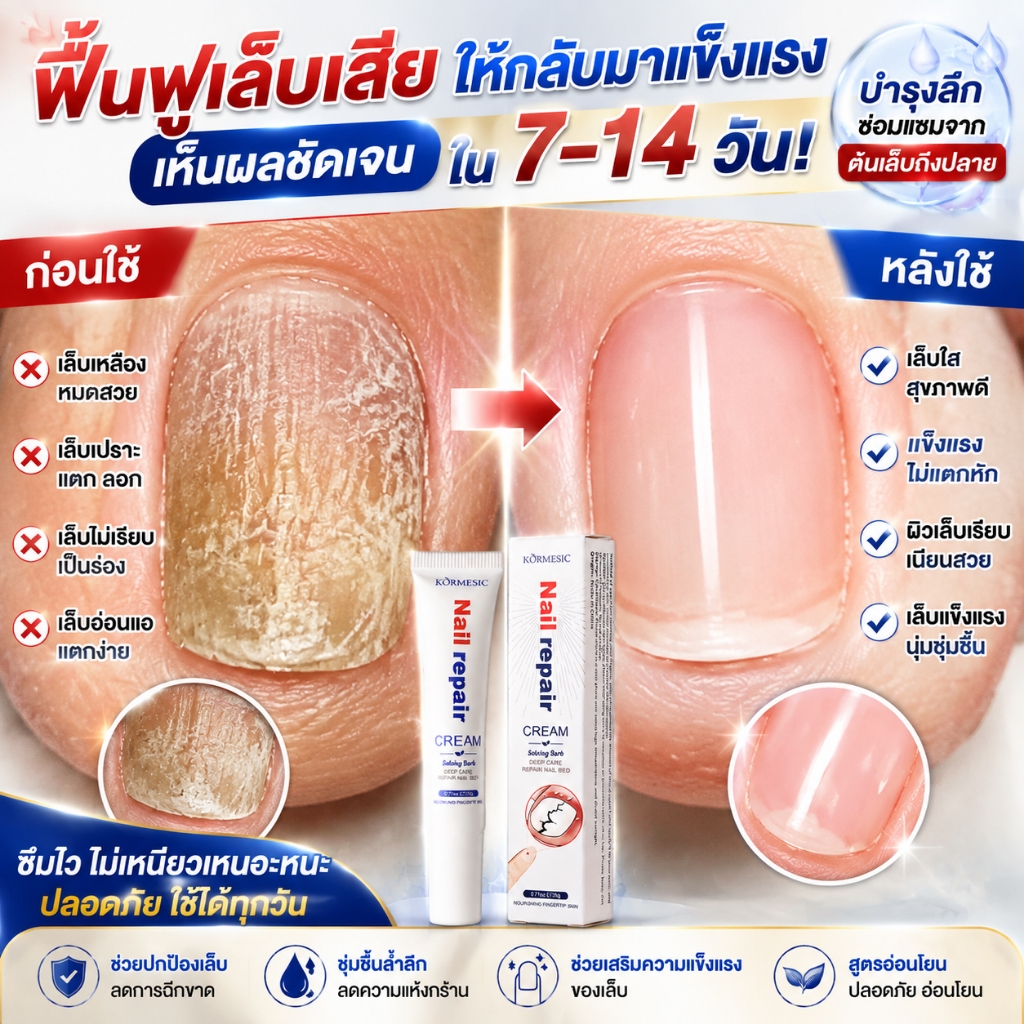 จัดส่งรวดเร็ว รักษาเชื้อราเล็บ ซ่อมแซมเล็บ เชื้อราเล็บมือ ซึมซาบง่าย สูตรอ่อนโยน ไม่เหนียวเหนอะหนะ ใช้งานง่ายทุกวัน