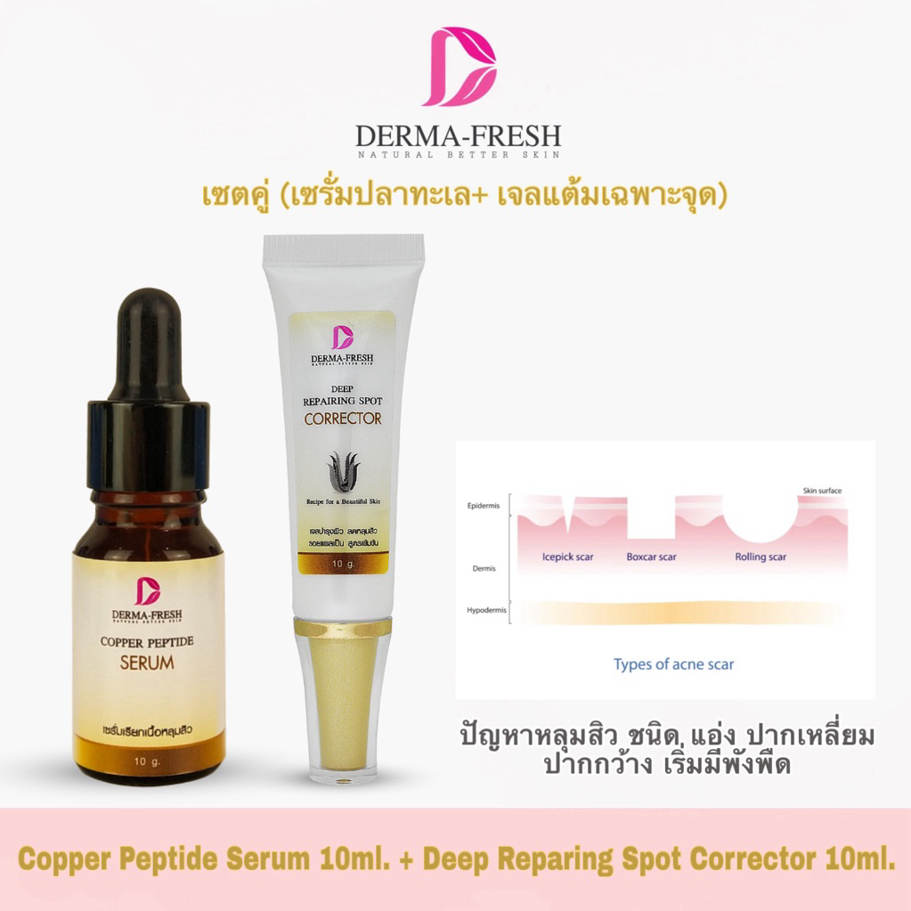 สูตร2️⃣เรียกเนื้อหลุมสิว(สำหรับหลุมสิวเกิน 5 ปี)