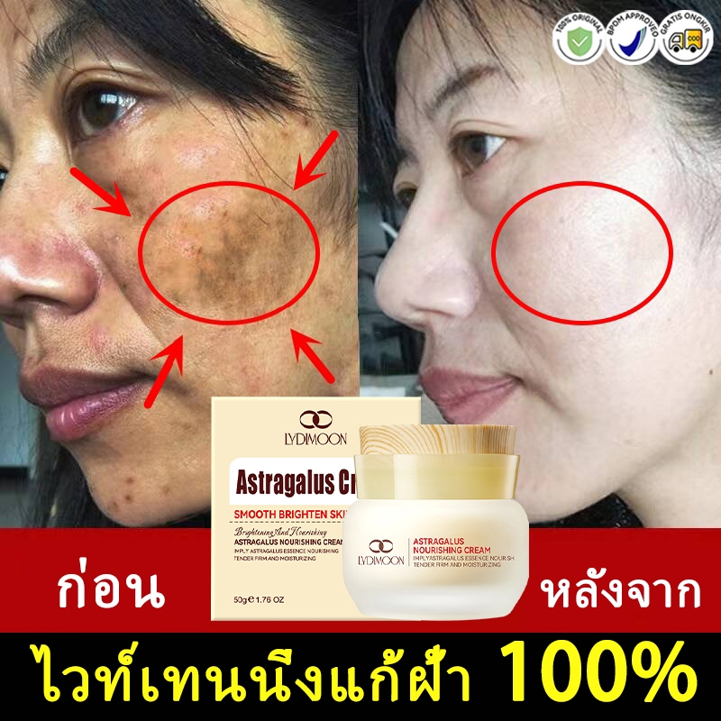 ครีมแก้ฝ้า กำจัดกระ ฝ้า จุดด่างดำ ลดจุดด่างดำ ให้ความชุ่มชื้น ฟื้นฟูผิว ลดสิว ฝ้า กระ เหมาะกับผิวแพ้ง่าย