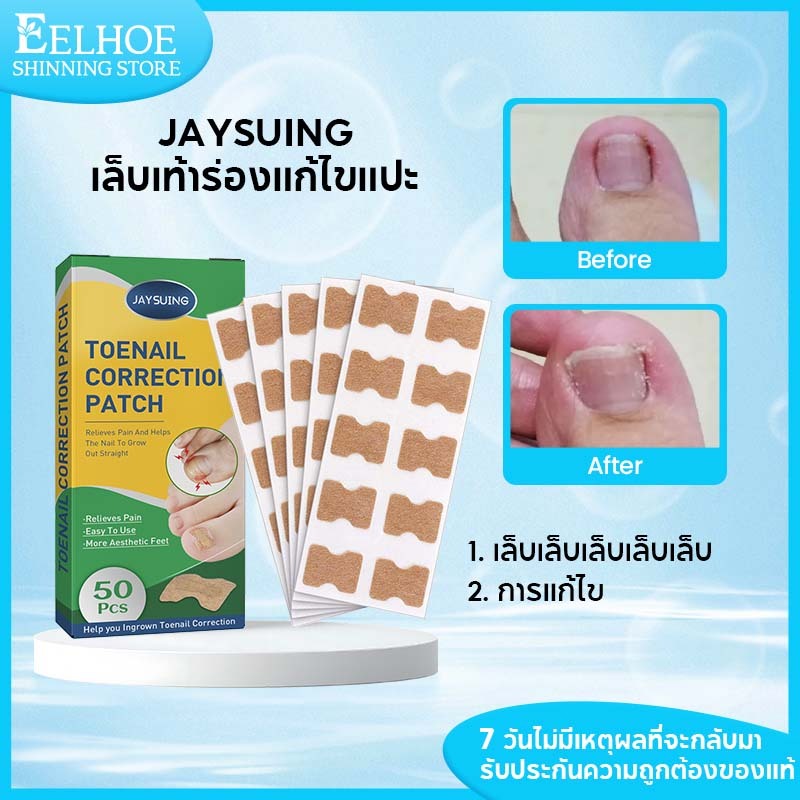 【ซื้อ1 แถม 1】Jaysuing เล็บเท้า เทปแปะเล็บ แผ่นแปะเล็บขบ เล็บขบ กันเล็บขบ แก้เล็บขบ (1กล่อง/50แผ่น)