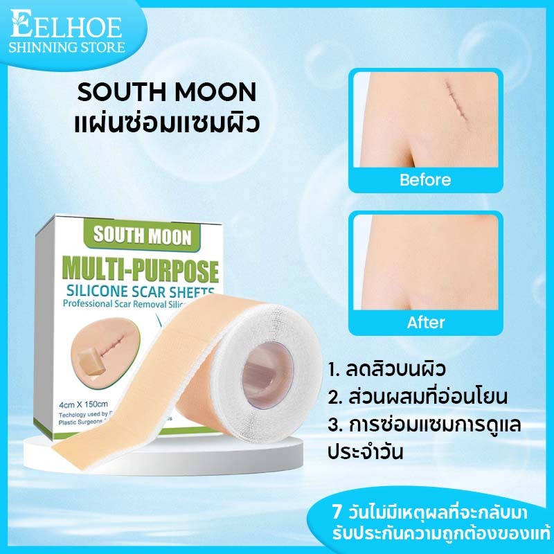 【1แถม1】South Moonแผ่นแปะ ซิลิโคน ลดรอยแผลเป็น แผ่นแปะแผลเป็น แผ่นซิลิโคนแปะแผลเป็น ซิลิโคนแปะแผลเป็น