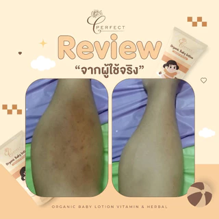 PERFECT Organic​ Baby​ Lotion​ โลชั่นเด็กออร์แกนิค บำรุงผิวขาวกระจ่างใส แก้ขาลาย ขนาด 100 ml​ หลอดเหลือง
