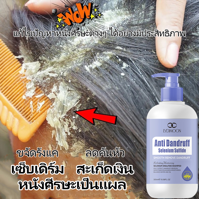 ยาสระผมขจัดรังแค แชมพู รังแค แชมพูแก้คัน 300ml แชมพู ผมมัน ขจัดรังแค ลดคันหัว แก้คัน ลดผมร่วง รักษาเซบเดิร์ม กลากเกลื้อน