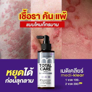 (เมดิเคลียร์) Medi-Klear สเปรย์สิวหลัง ขนคุด ผื่นคัน ผิวเชื้อรา Total Care Spray
