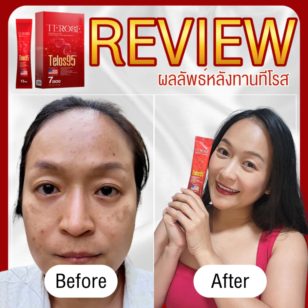 TELOS95 วิตามินอาหารเสริมชะลอวัย JAPANELAB thumbnail 9