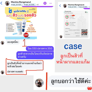 ชุดสิวหายด่วน (โฟม40g + เจลแต้มสิว) DERRATU เคลียร์ทุกสิว สิวอุดตัน สิวอักเสบ สิวยุบไว รอยสิวจางเร็ว หน้าใสไกลสิว