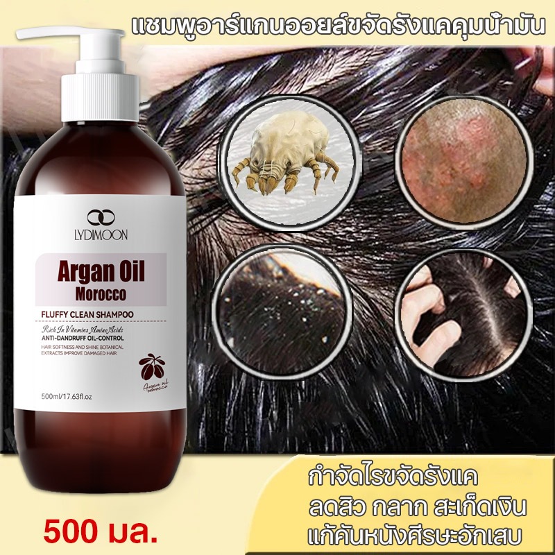 แชมพู รังแค แชมพูแก้คัน แชมพูรังแค แชมพู ผมมัน 500ml แก้รังแค แก้คัน ลดความมัน ลดผมร่วง รักษาเซบเดิร์ม กลาก กำจัดไร