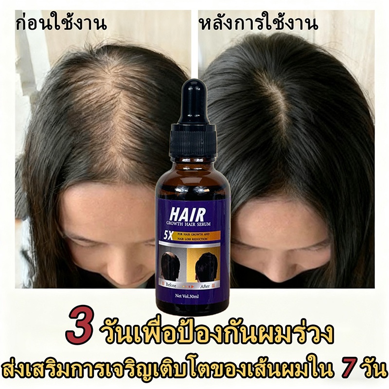 เซรั่มบำรุงผม ช่วยกระตุ้นการเจริญเติบโตของเส้นผม เพิ่มความชุ่มชื้น บำรุงล้ำลึก และดูแลหนังศีรษะ