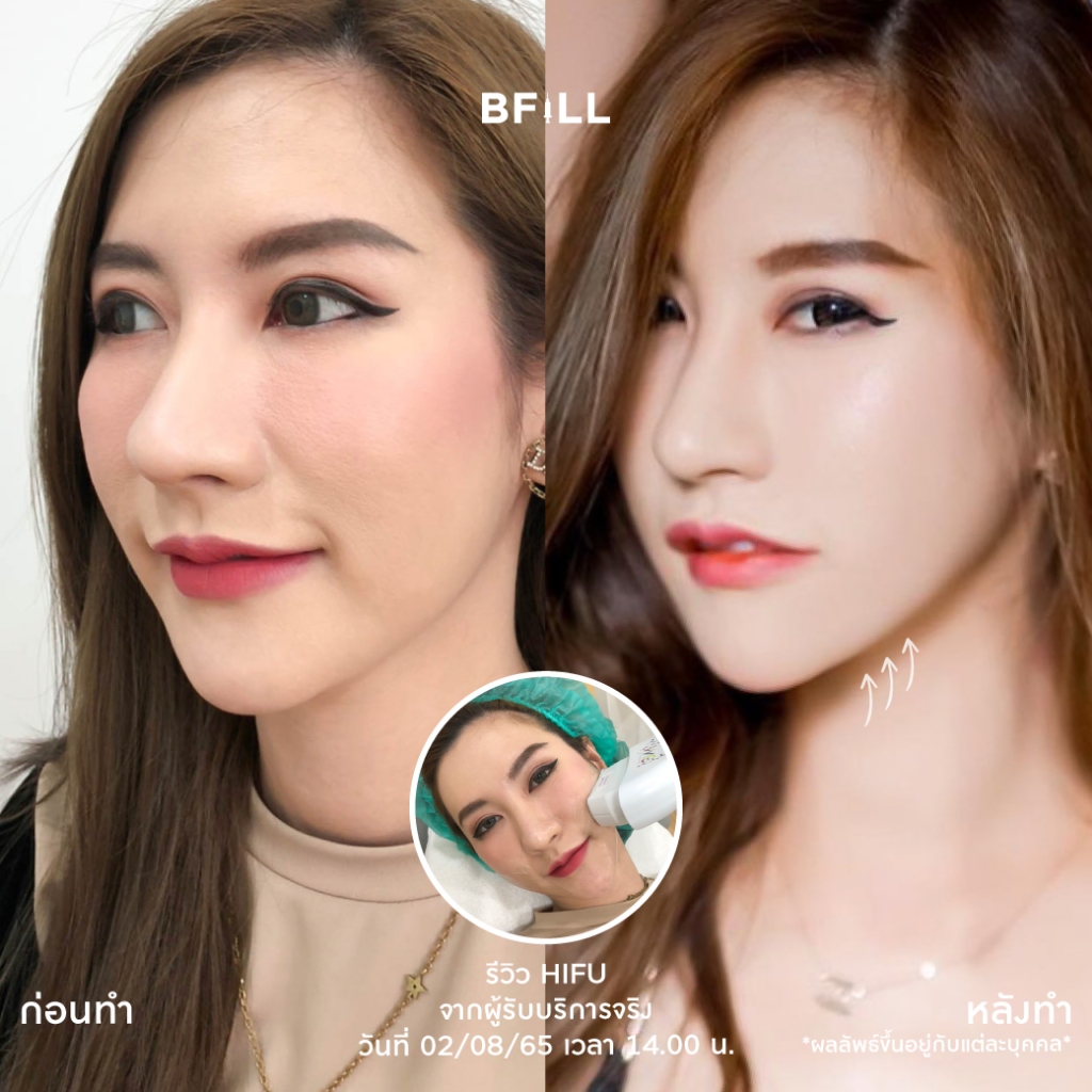 รูปภาพ 2