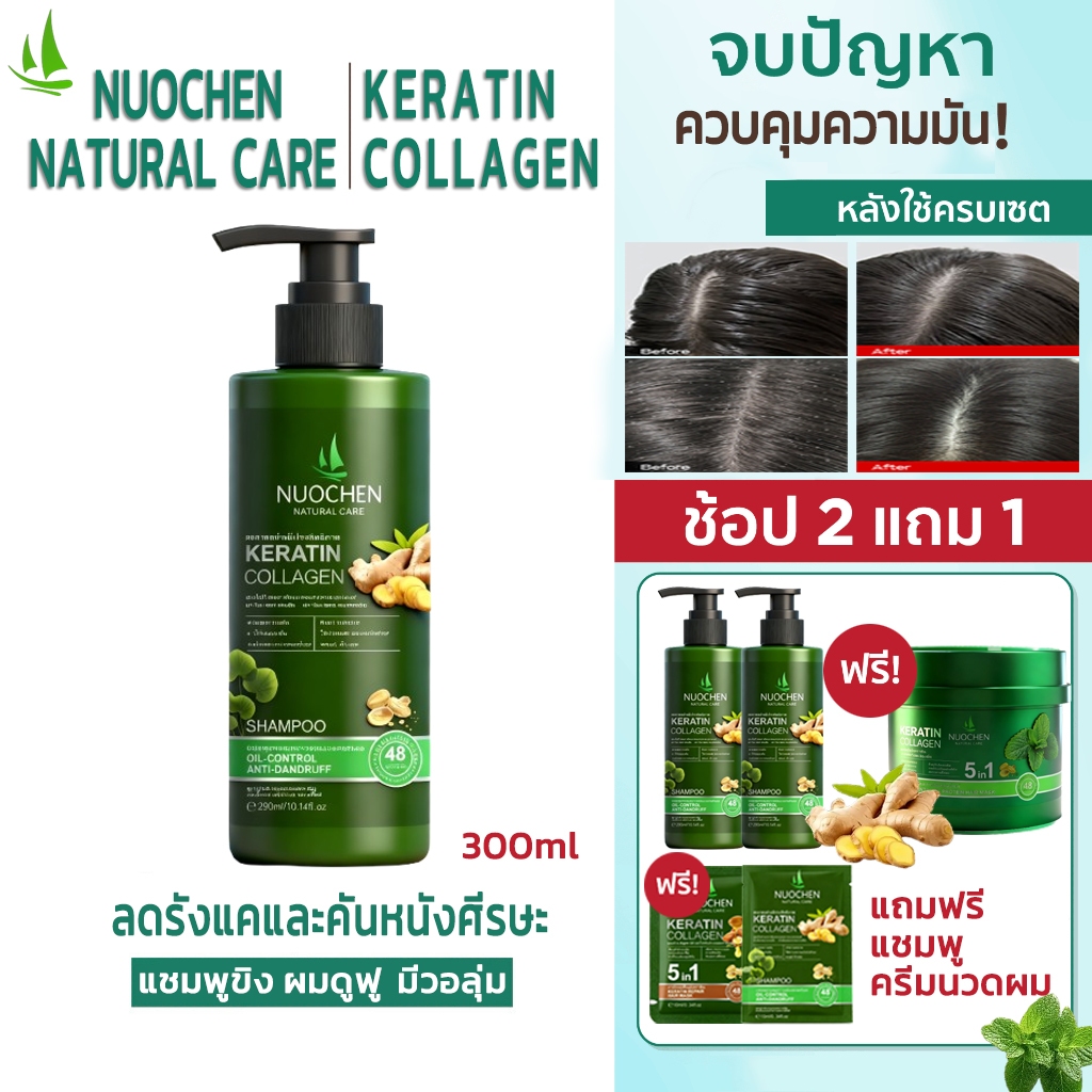 ได้รับของภายใน 48 ชม. แชมพู น้ำมันหอมระเหยขิง ลดรังแคและคันหนังศีรษะ ทำความสะอาดและให้ความสบายแก่หนังศีรษะ ผมดูฟู มีวอลุ