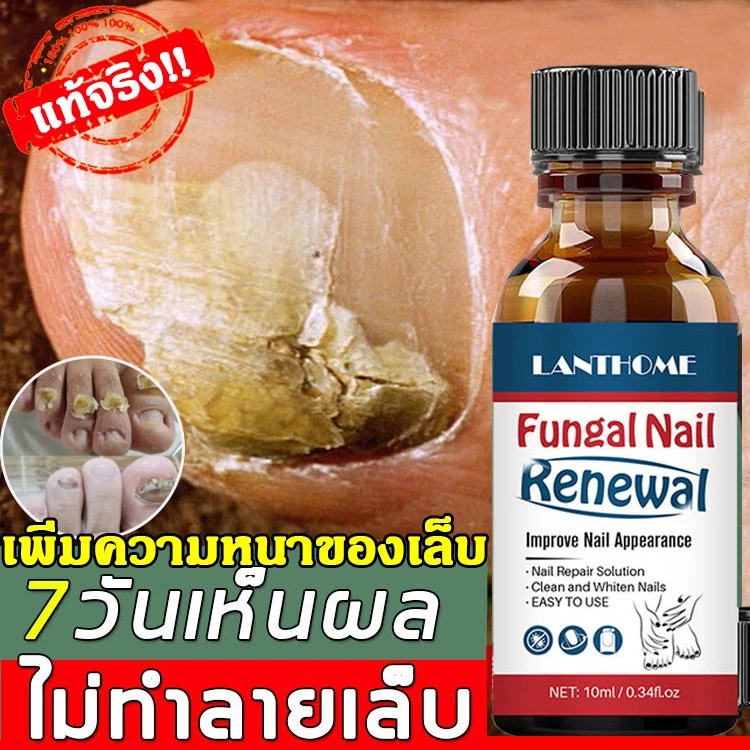 ฆ่าเชื้อราที่เล็บ เซรั่มบำรุงเล็บ ยาเชื้อราเล็บ ซรั่มรักษาเล็บ เชื้อราเล็บ ครีมบำรุงเล็บ ยาฆ่าเชื้อราเล็บ 10ml