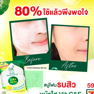 BK Acne Natural Whipped Soap C&E 60 กรัม