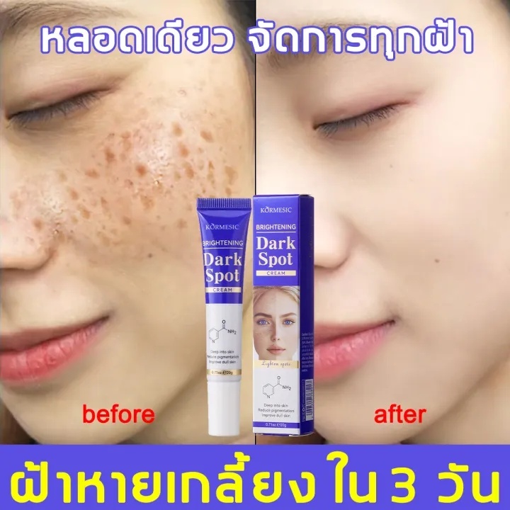 ครีมทาฝ้ากระ 7 วัน ฝ้าเกลี้ยง ครีมแก้ฝ้าผิวขาว อุดมไปด้วยไนอาซินาไมด์ ยับยั้งการสร้างเมลามิน ครีมแก้ฝ้าผิวขา ทาฝ้า