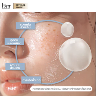 H.E.M ANTI BLEMISH MOISTURE CONTROL GEL เอช.อี.เอ็ม แอนตี้ เบลมมิช มอยเจอร์ คอนโทรล เจล 30G
