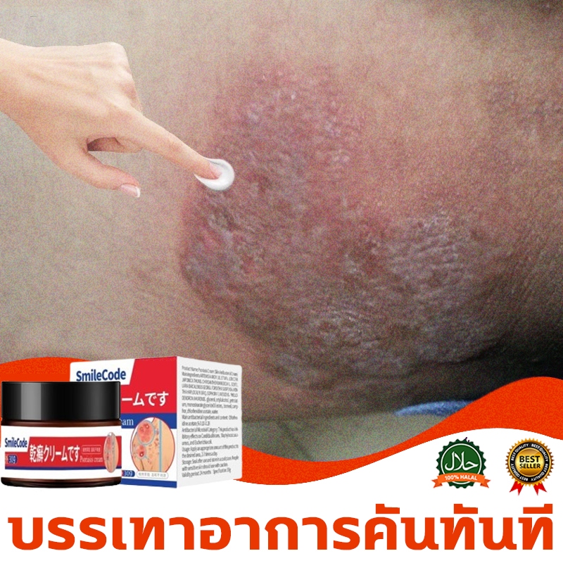 ☘️ครีมแก้คัน ครีมลดอาการคัน สะเก็ดเงินครีม 30g โรคผิวหนัง เกลื้อน กลาก คัน สมุนไพร แก้คันเรื้อรัง คันในร่มผ้า