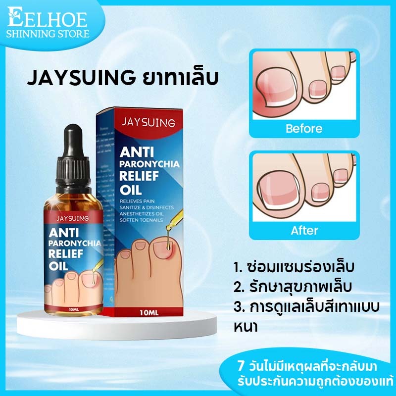 Jaysuing ยาทาเล็บขบ 10ml เซรั่มเล็บขบ เล็บขบnail serum  ยาเล็บขบ กันเล็บขบ บํารุงเล็บ เซรั่มซ่อมแซมเล็บแทรก
